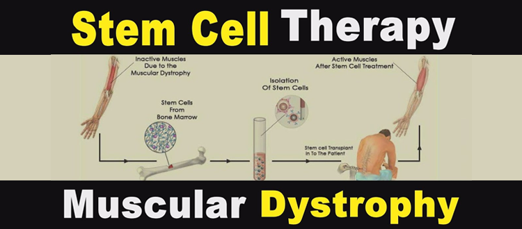 muscular dystrophy