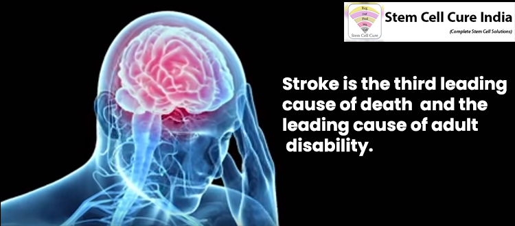 brain stroke injury treatment