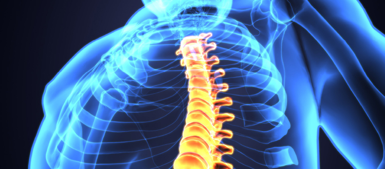 spinal cord injury