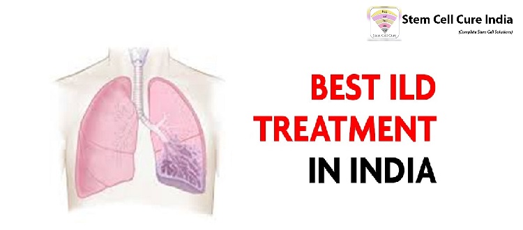 ild treatment in india, stem cell therapy
