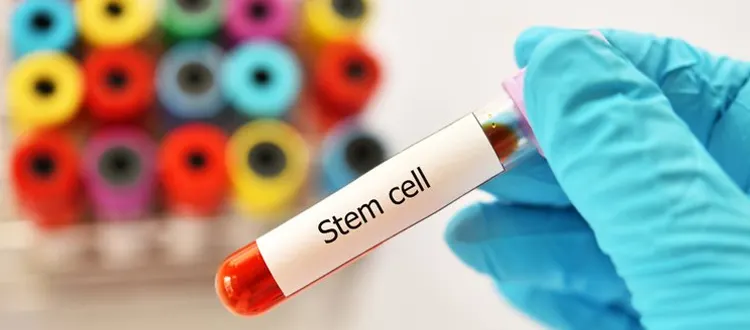 stem cell