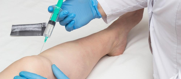 stem-cell-injections-2