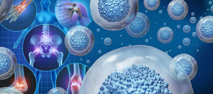 orthopedic-stem-cell-therapy