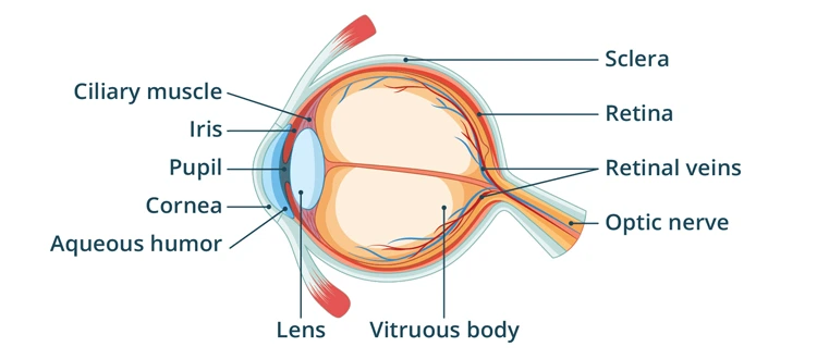 optic nerve atropy