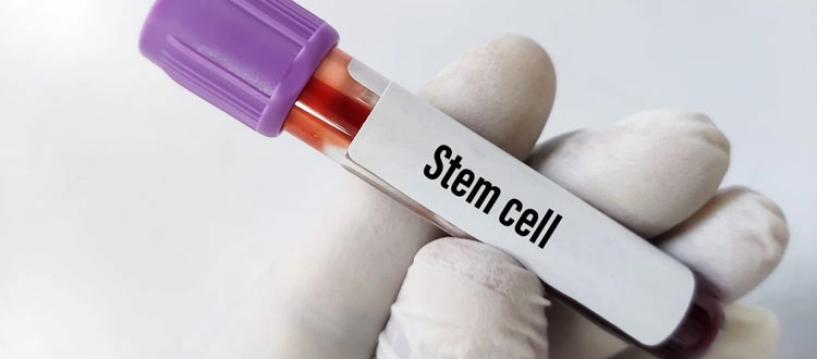 stem-cell