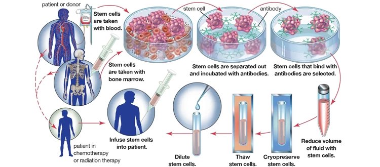 stem cell