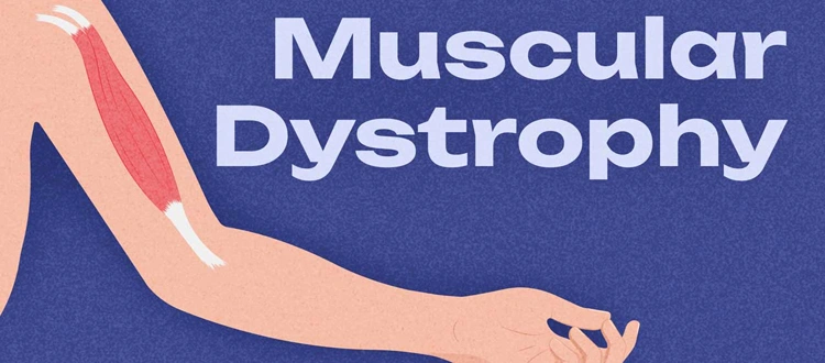 muscular dystrophy