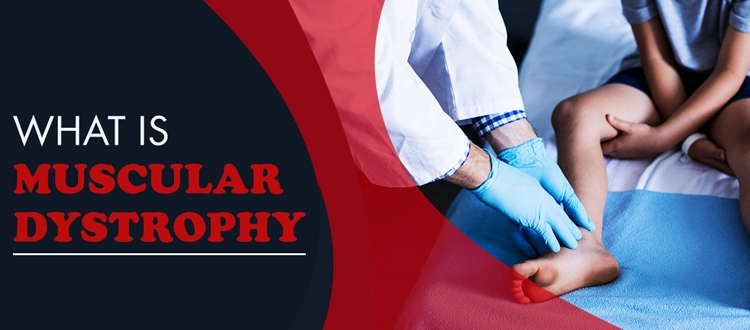 muscular dystrophy