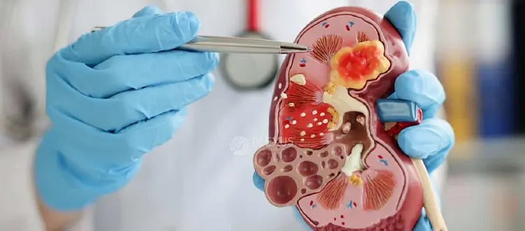 stem cell treatment in india
