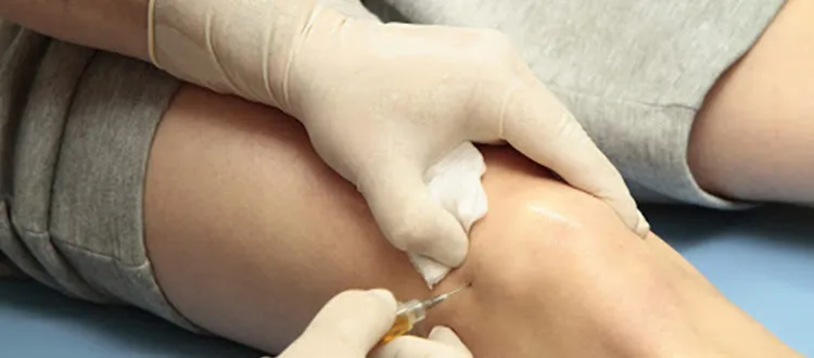 Stem Cell Therapy for Osteoarthritis in India