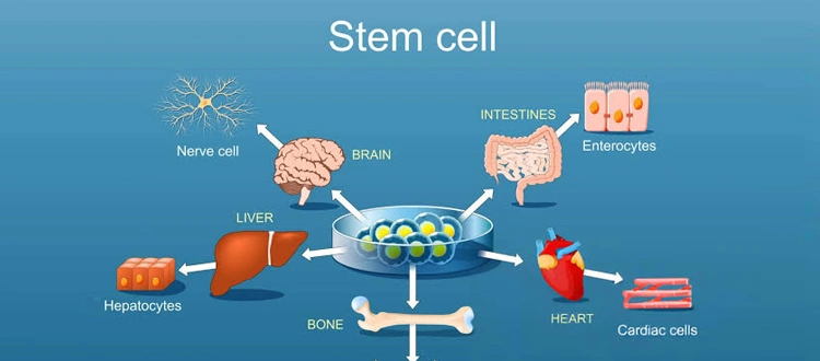 stem cell treatment
