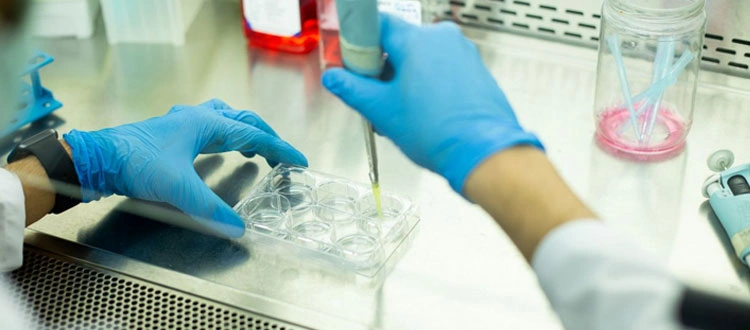 stem cell therapy
