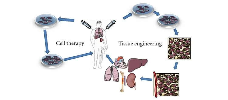stem cell treatment