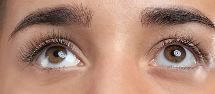 macular dystrophy