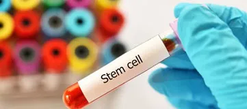 stem cell