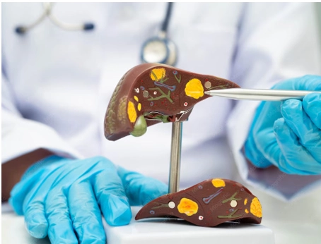 Doctor pointing at human liver model with tweezers.