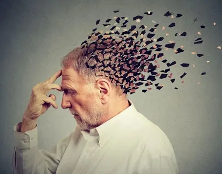 alzheimer-dementia-disease